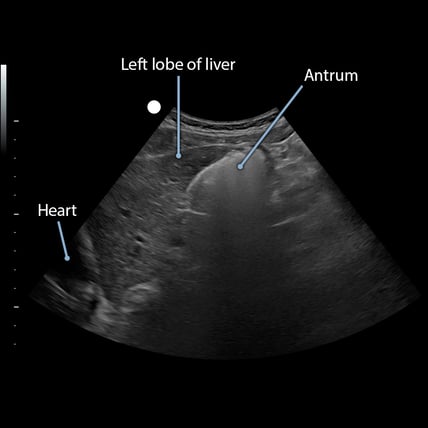 dvr_20240508_1026_00_49_23_Solids-Sag-5min-001