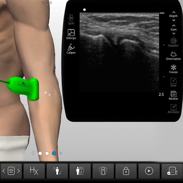 elbow_case_screen__48513 elbow_case_screen__48513