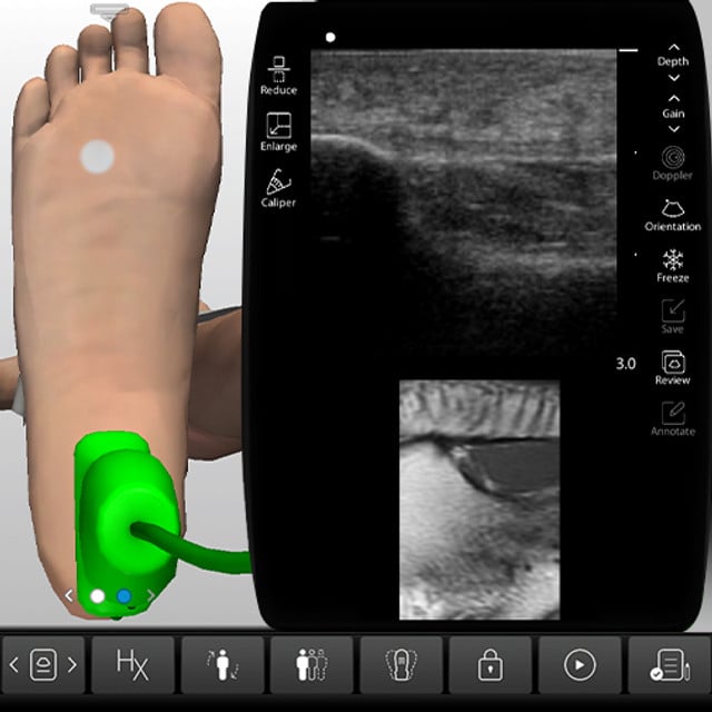 foot_case_screen__51754 foot_case_screen__51754