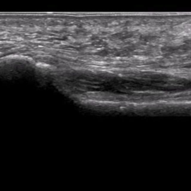 foot_ultrasound__79355