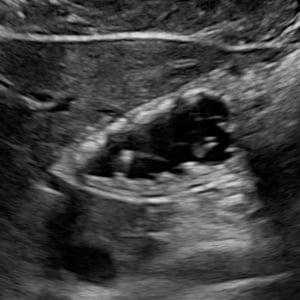 gastric