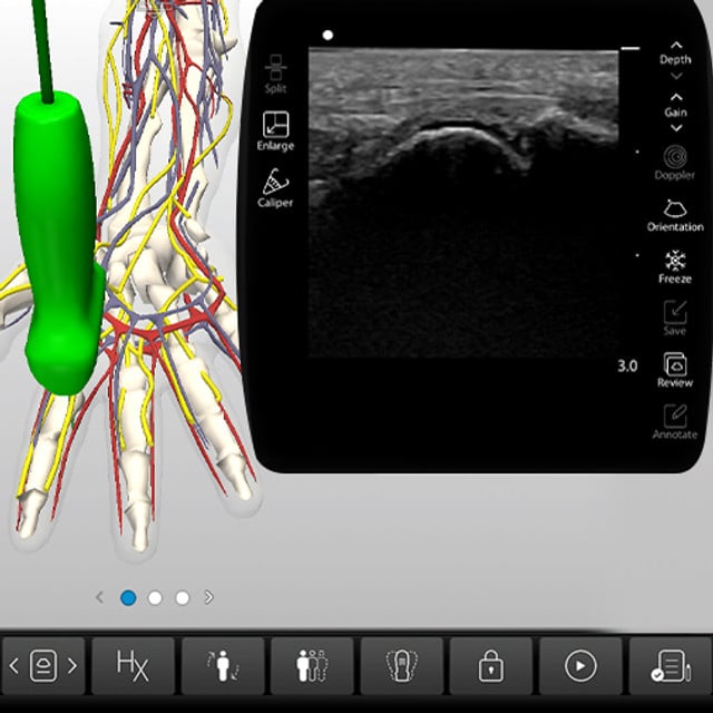 hand_fingers_case_screen__88077 hand_fingers_case_screen__88077