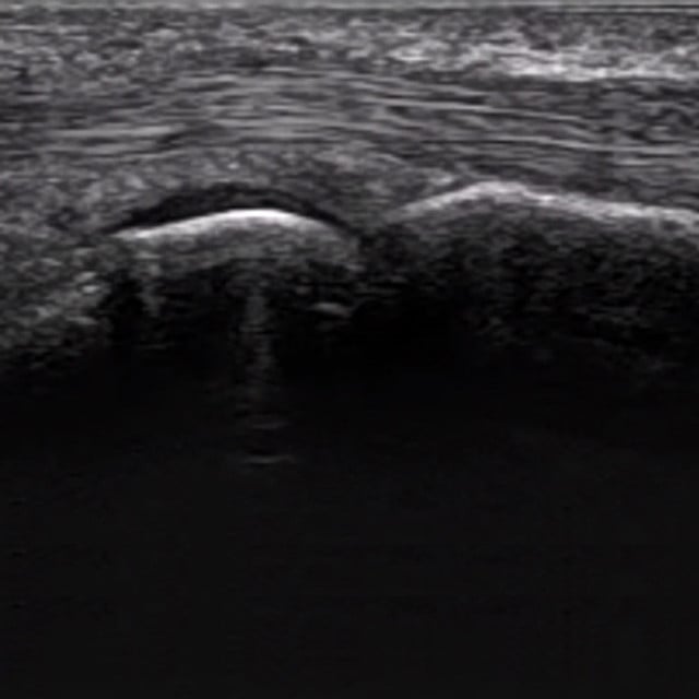 hand_fingers_ultrasound__98761