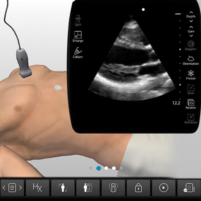 heart_case_screen__26760 heart_case_screen__26760
