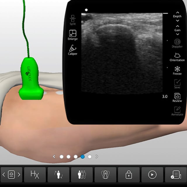 hip_case_screen__17842 hip_case_screen__17842