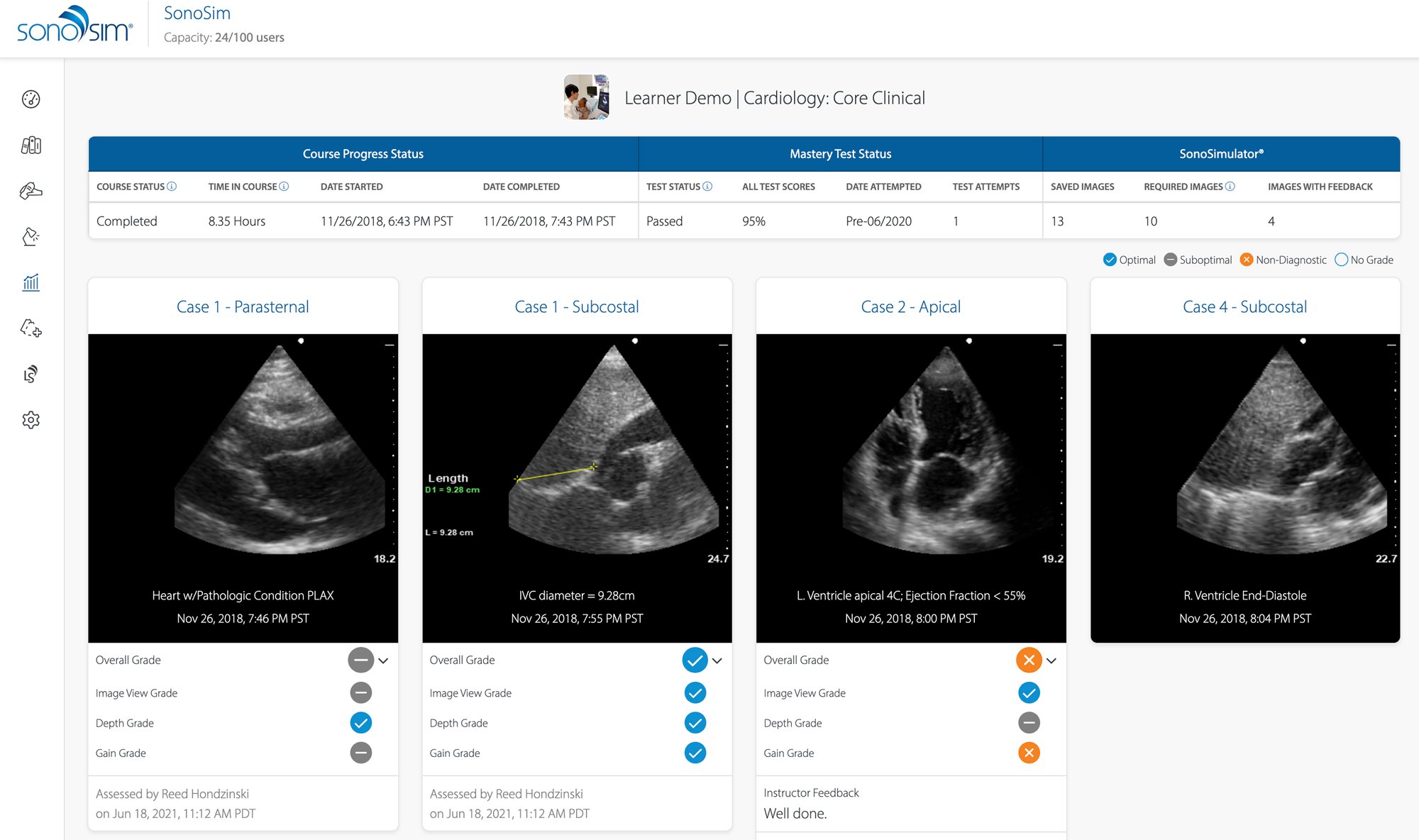Completed assignments can be graded manually or using automated ultrasound image review