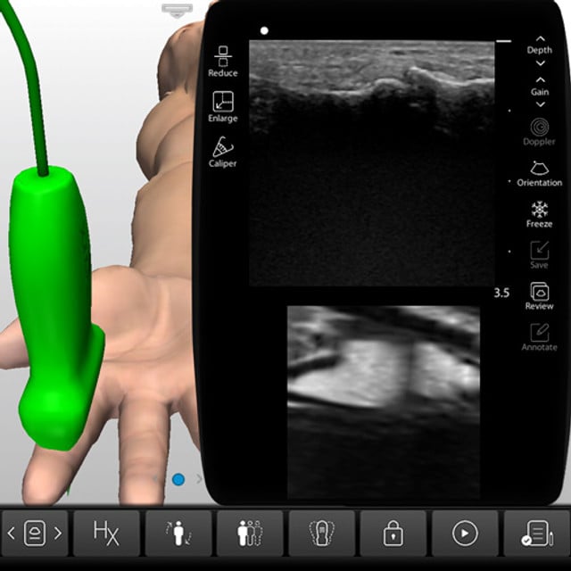 intro_to_msk_case_screen__96437 intro_to_msk_case_screen__96437