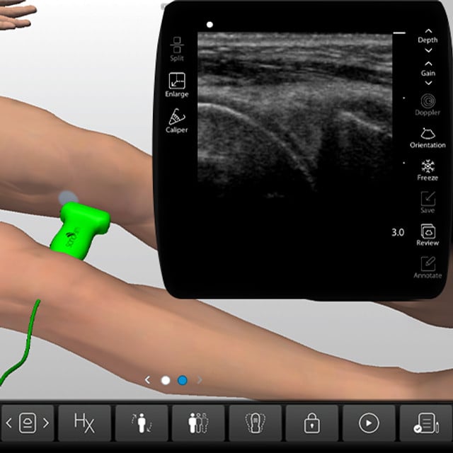 knee_case_screen__49055 knee_case_screen__49055