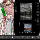 Leg Arterial
