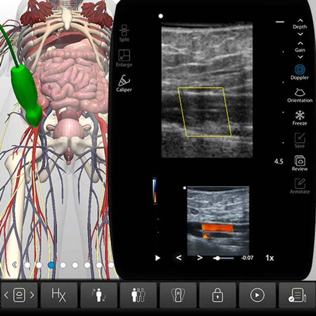 leg_arterial_case_screen__57307 leg_arterial_case_screen__57307