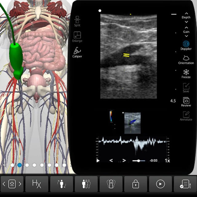 leg_venous_case_screen__62103 leg_venous_case_screen__62103