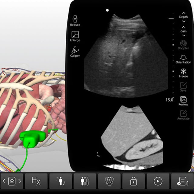 liver_case_screen__07499 liver_case_screen__07499