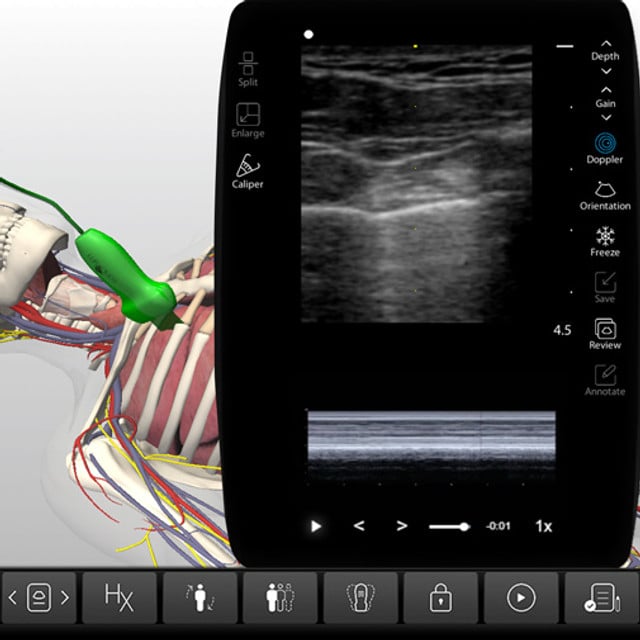 lungs_case_screen__59533 lungs_case_screen__59533