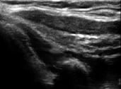 PA and nurse practitioner specialty ultrasound image