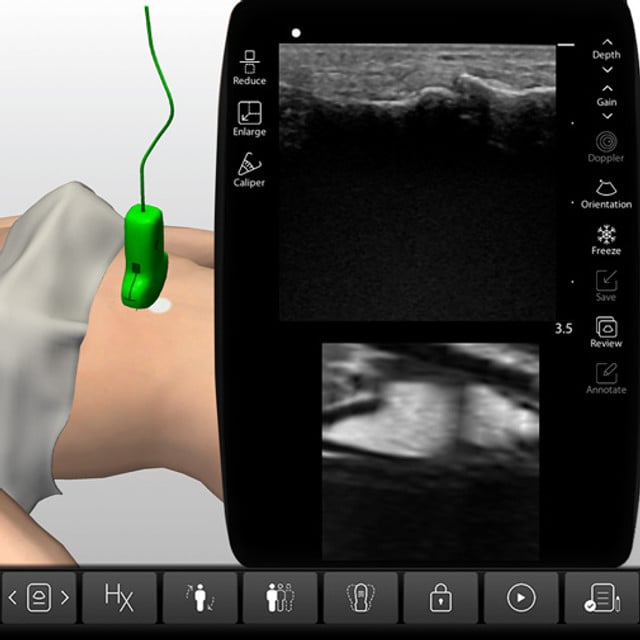 pancreas_case_screen__30310 pancreas_case_screen__30310