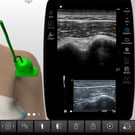 Biceps Tendon Sheath Injection