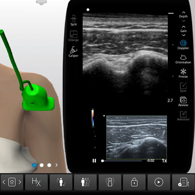 procedure_bicep_case_screen__69736 procedure_bicep_case_screen__69736