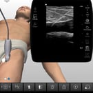 Femoral Line Placement