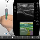 Glenohumeral Joint Injection & Aspiration