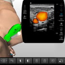 Internal Jugular Vein Cannulation