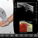 Metatarsophalangeal Joint Injection & Aspiration