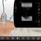 Ultrasound-Guided Paracentesis Procedure