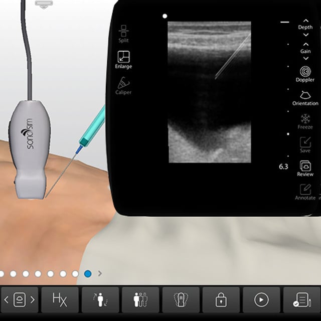 procedure_paracentesis_case_screen__39027 procedure_paracentesis_case_screen__39027