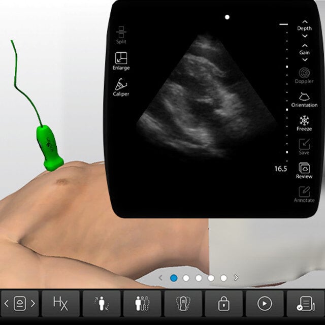 procedure_pericardiocentesis_case_screen__02482-1 procedure_pericardiocentesis_case_screen__02482-1