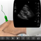 Ultrasound-Guided Pericardiocentesis Procedure