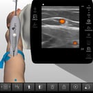 Peripheral Venous Access