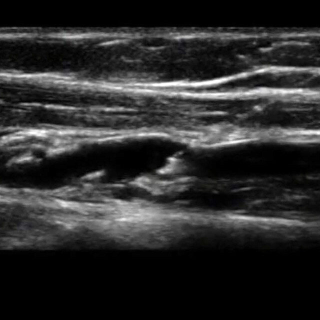 procedure_peripheral_ultrasound__34317