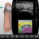 Plantar Fasciitis Ultrasound-Guided Injection