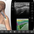 Subacromial-Subdeltoid Bursa Injection & Aspiration