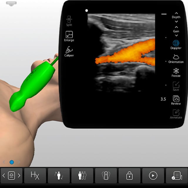 procedure_subclavian_case_screen__05323 procedure_subclavian_case_screen__05323
