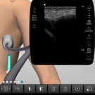 Ultrasound-Guided Thoracentesis Procedure