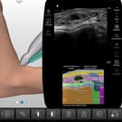 Tibiotalar Joint Injection & Aspiration
