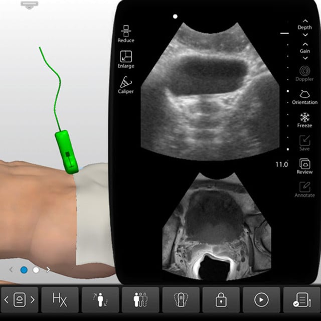 prostate_devices_1__74108 prostate_devices_1__74108