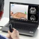 Prostate