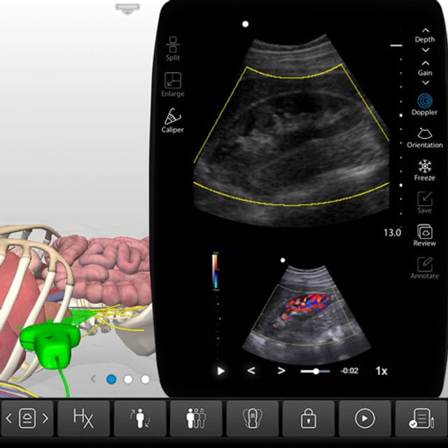 renal_case_screen__76165 renal_case_screen__76165