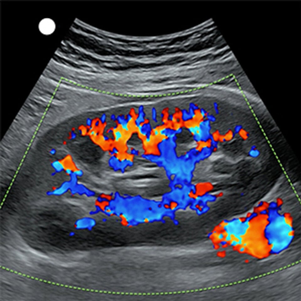 renal_transplant_store