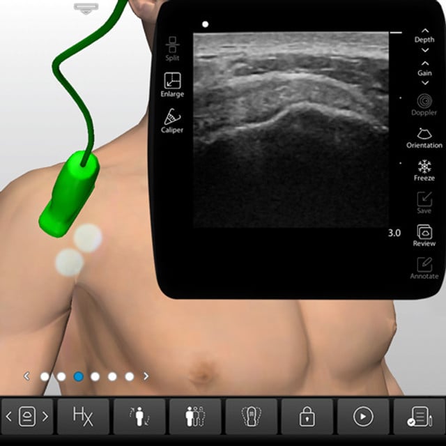 shoulder_case_screen__55279 shoulder_case_screen__55279