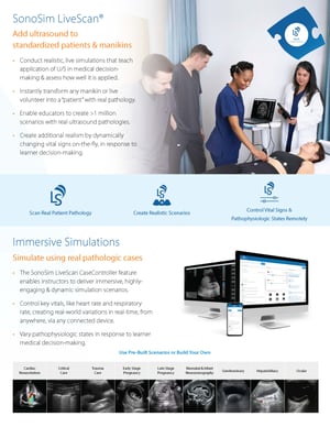 What is SonoSim LiveScan