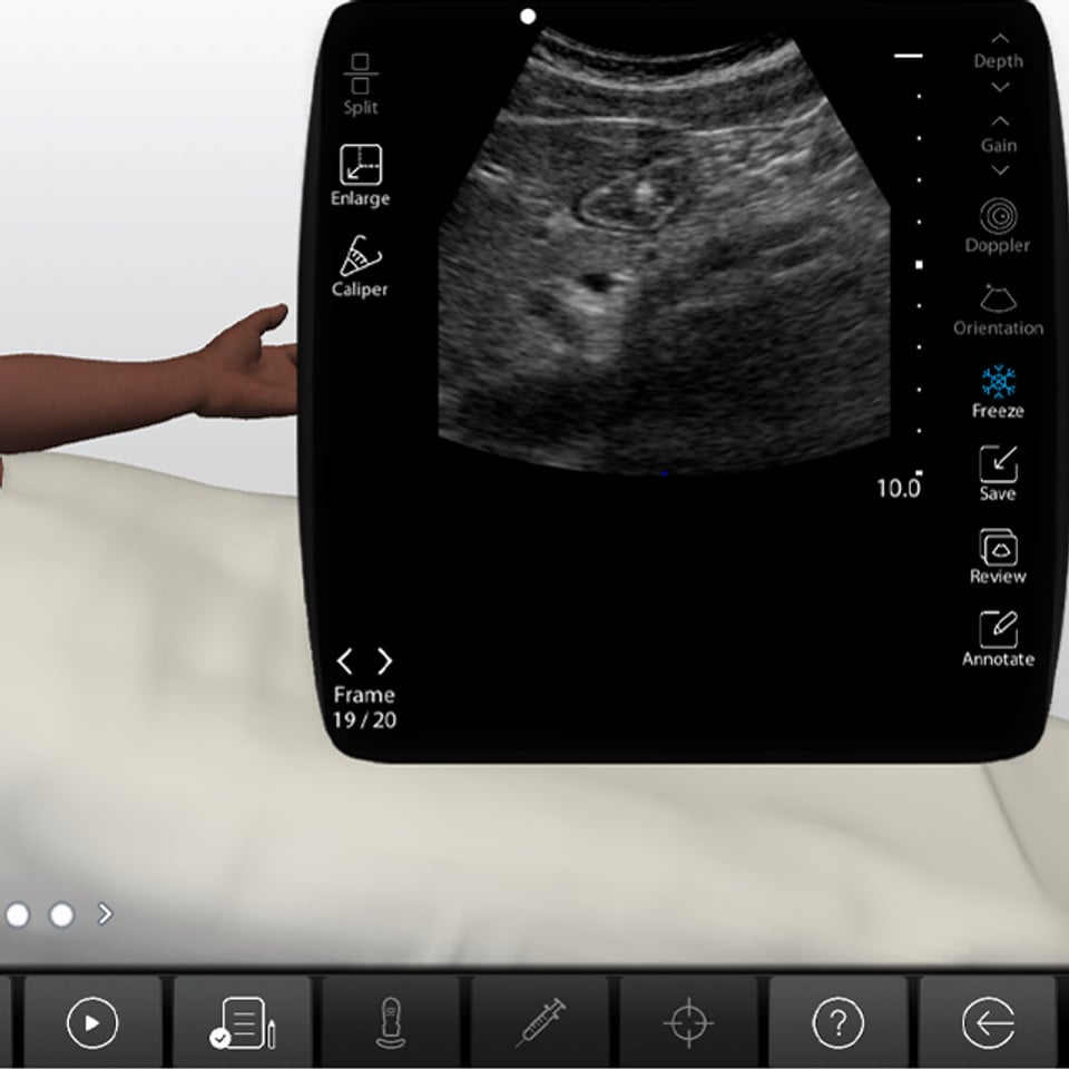 Gastric_Ultrasound_case_screen__15245