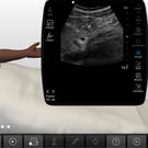 Gastric Ultrasound