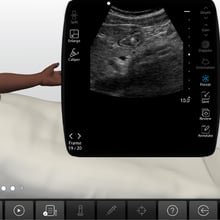 Gastric_Ultrasound_case_screen__15245