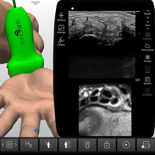 soft_tissue_case_screen__79844 soft_tissue_case_screen__79844