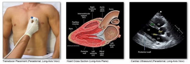 sonosim-course-1-1024x350