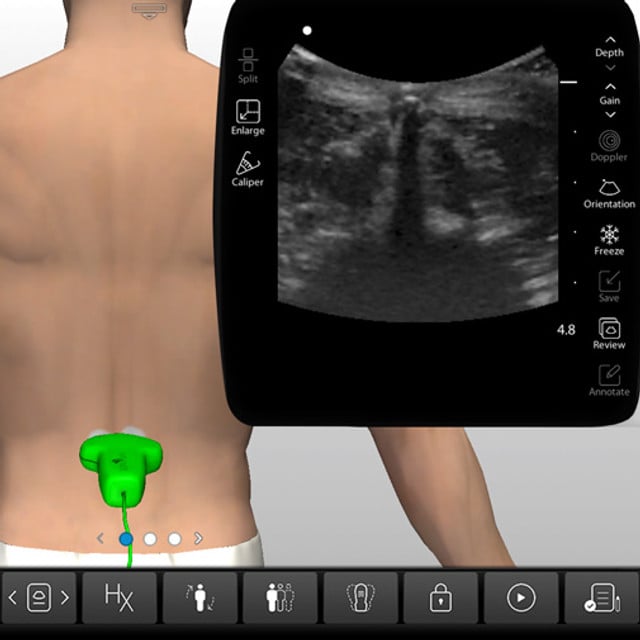 spine_case_screen__76433 spine_case_screen__76433