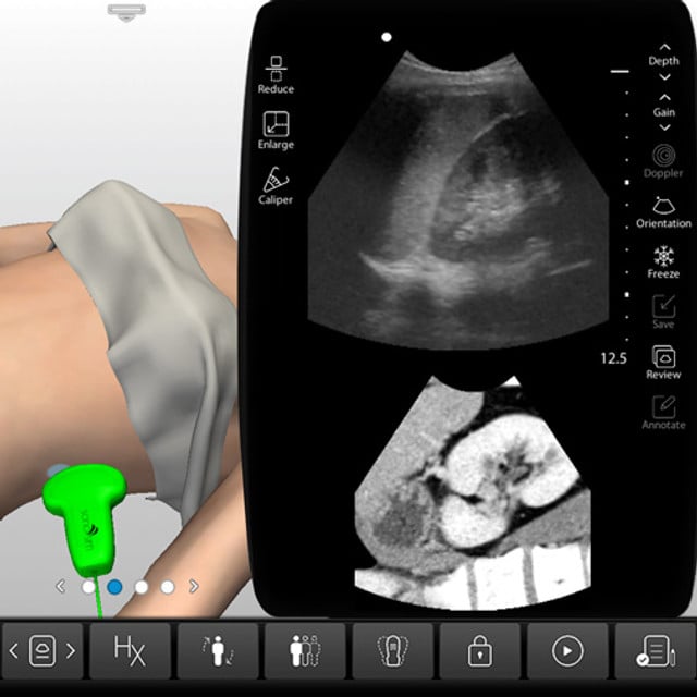 spleen_case_screen__18611 spleen_case_screen__18611