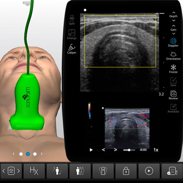 thyroid_case_screen__18399 thyroid_case_screen__18399
